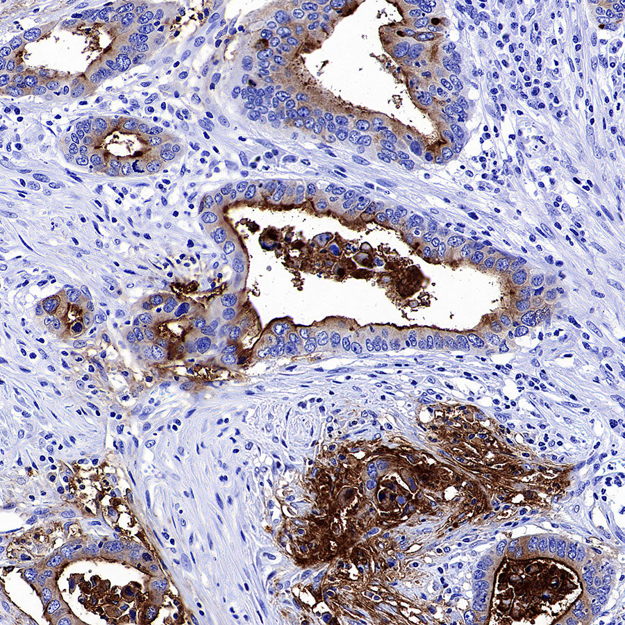 MUC17 Recombinant Rabbit mAb (SDT-3951-56)