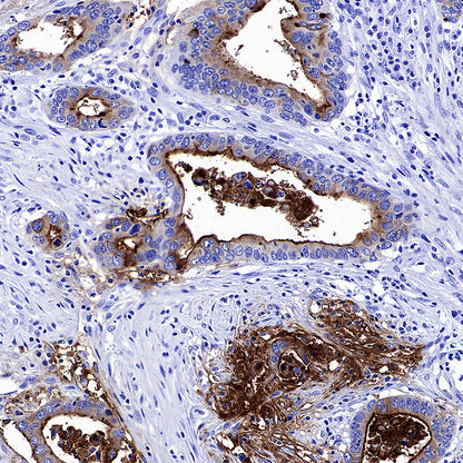 MUC17 Recombinant Rabbit mAb (SDT-3951-56)