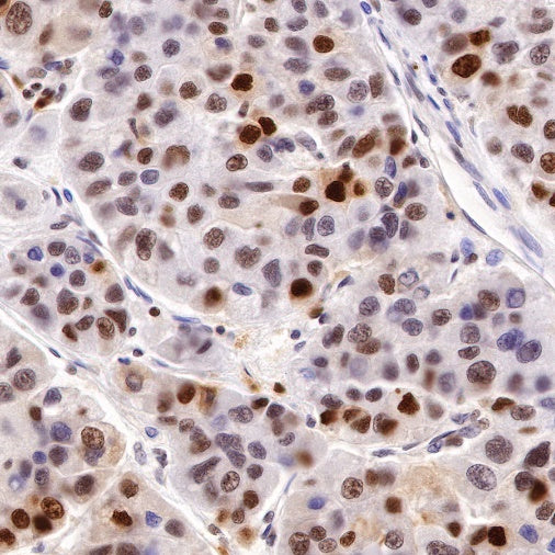 PCNA Recombinant Rabbit mAb (SDT-297-116)