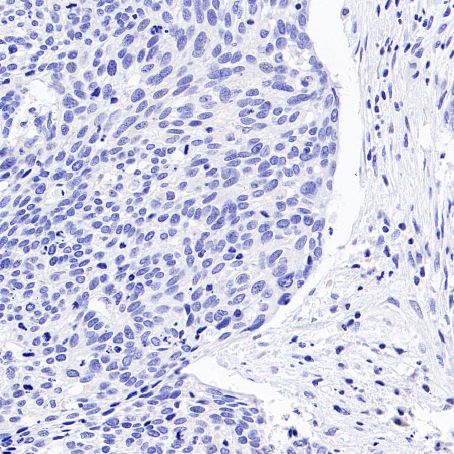 ASGR2 Recombinant Rabbit mAb (SDT-2059-47)