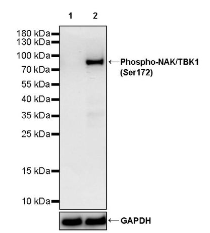 Phospho-NAK/TBK1 (Ser172) Recombinant Rabbit mAb (S-2481-14)