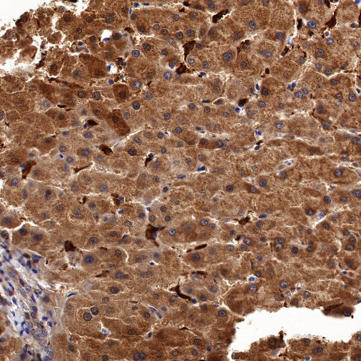 Glutathione Peroxidase 1 Recombinant Rabbit mAb (S-1714-17)