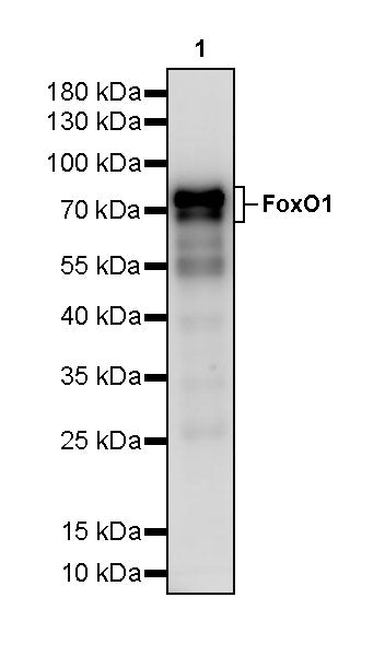 FoxO1 Recombinant Rabbit mAb (S-5118)