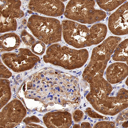 ALDH9A1 Recombinant Rabbit mAb (S-4115-48)