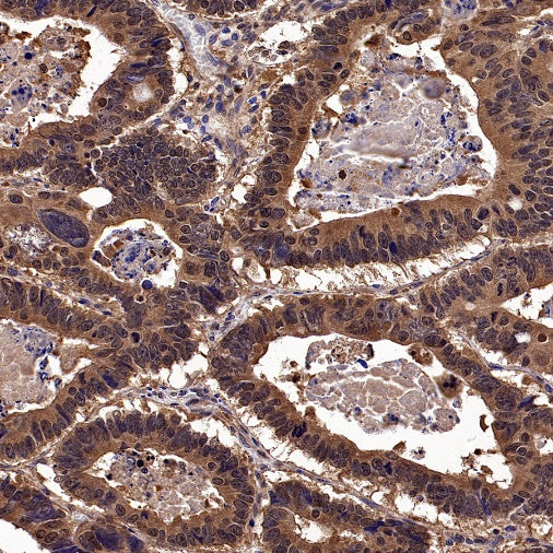 LMPTP Rabbit Polyclonal Antibody