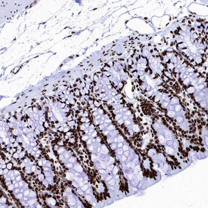Histone H4 (Lactyl K8) Recombinant Rabbit mAb (S-3243-36)