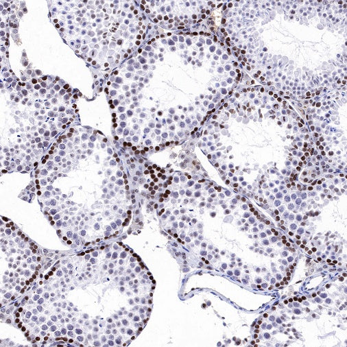Histone H3 (di methyl K14) Recombinant Rabbit mAb (S-R414)
