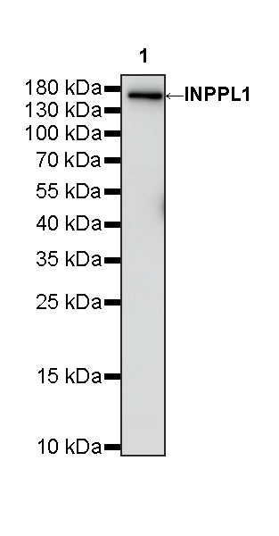 INPPL1 Recombinant Rabbit mAb (S-4567-47)