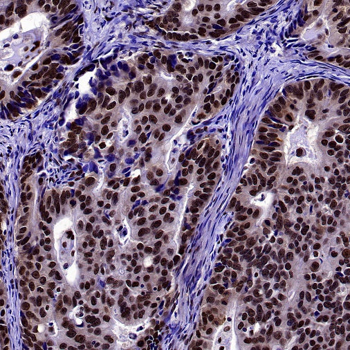 U2AF1 Recombinant Rabbit mAb (S-2384)