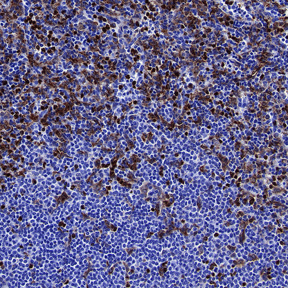 LPCAT2 Recombinant Rabbit mAb (S-4239-18)
