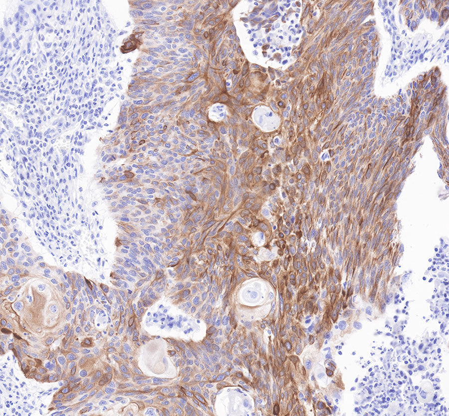 S-RMab® Cytokeratin 7 Recombinant Rabbit  mAb,PBS Only (SDT-121-17)