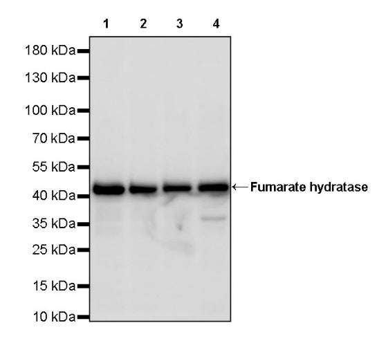 Fumarate hydratase Recombinant Rabbit mAb, PBS Only (SDT-2434-54)