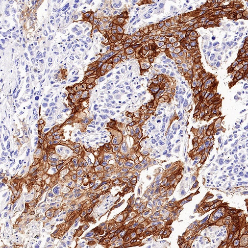 Integrin beta 6 Recombinant Rabbit mAb (SDT-1445-78)