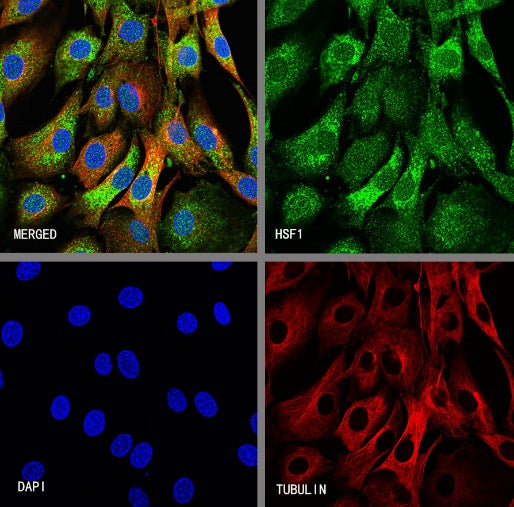 HSF1 Recombinant Rabbit mAb (S-3139-44)
