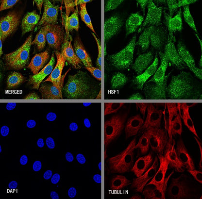 HSF1 Recombinant Rabbit mAb (S-3139-44)