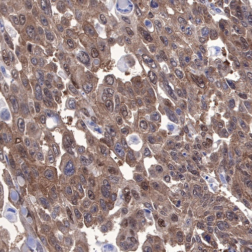 STIP1 Recombinant Rabbit mAb (S-680-39)