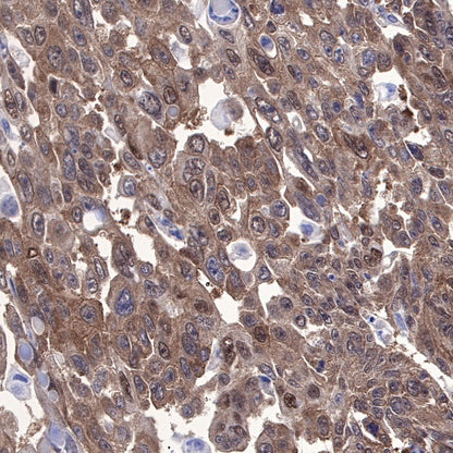 STIP1 Recombinant Rabbit mAb (S-680-39)