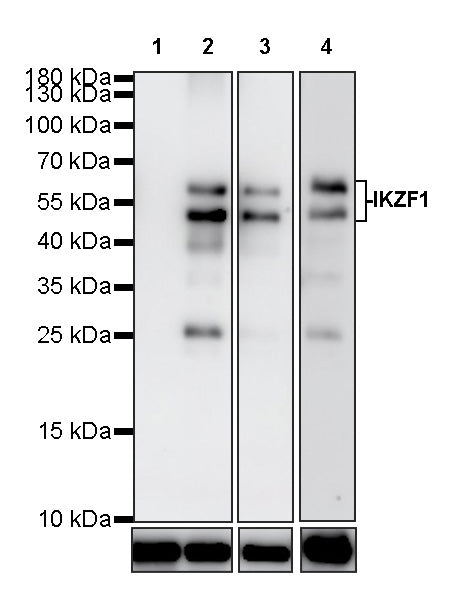 IKZF1 Recombinant Rabbit mAb (S-4176-17)