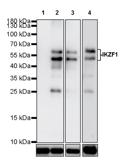 IKZF1 Recombinant Rabbit mAb (S-4176-17)
