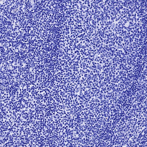 α-Synuclein Recombinant Rabbit mAb (S-441-86)