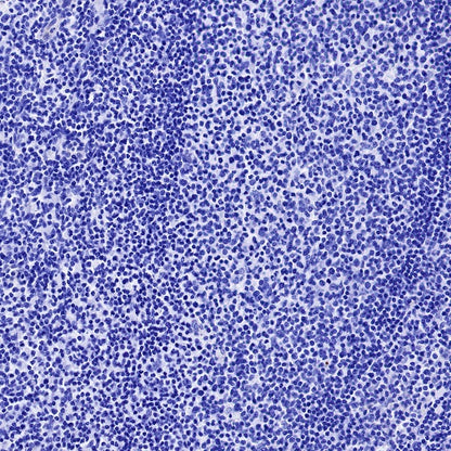 α-Synuclein Recombinant Rabbit mAb (S-441-86)