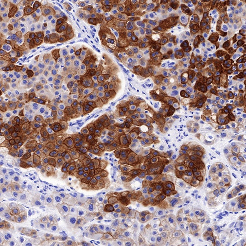 CK8/18 Recombinant Rabbit mAb (SDT-P005)