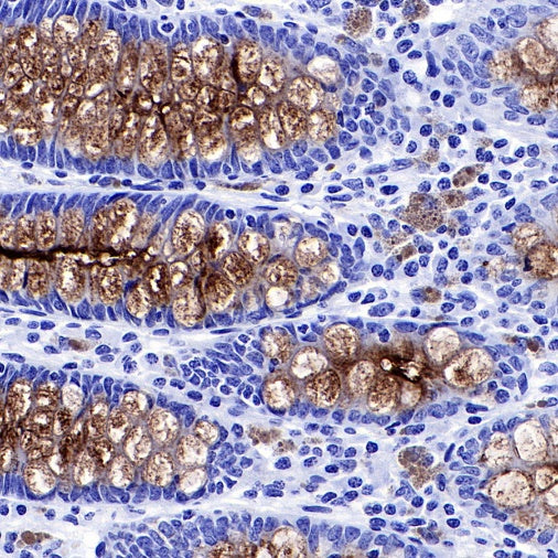 S-RMab® MUC1/EMA Recombinant Rabbit mAb (SDT-776-49)