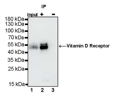 Vitamin D Receptor Recombinant Rabbit mAb (S-1719-7)