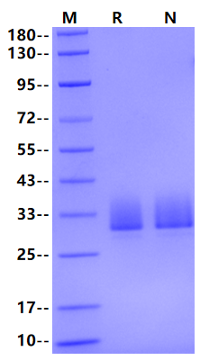 Angiopoietin-like 3/ANGPTL3(17-220) His Tag Protein, Human