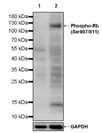 Phospho-Rb (Ser807/811) Recombinant Rabbit mAb (S-2215-52)