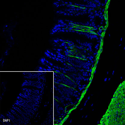 alpha smooth muscle Actin Recombinant Rabbit mAb (Alexa Fluor® 488 Conjugate) (SDT-132-63)