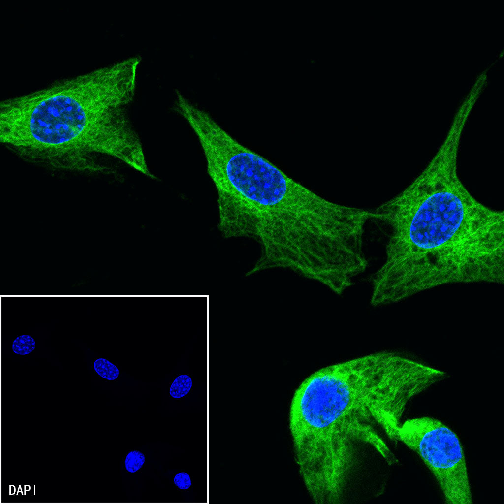 Beta II tubulin Rabbit polyclonal antibody
