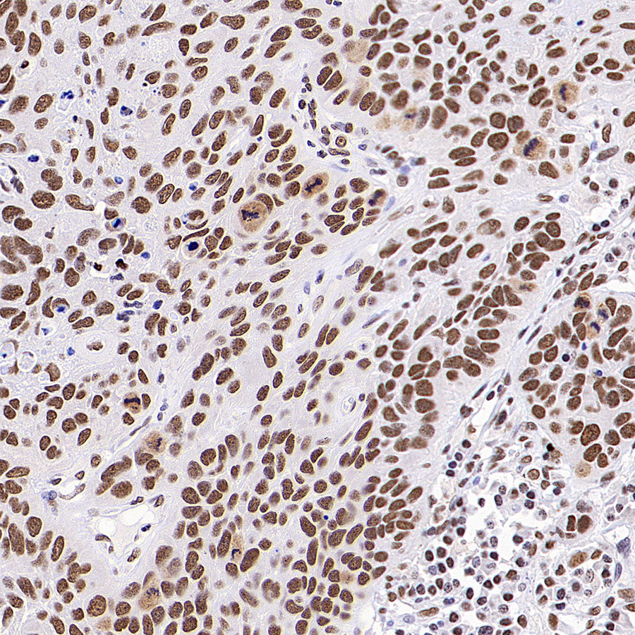 HNRNPL Rabbit Polyclonal Antibody