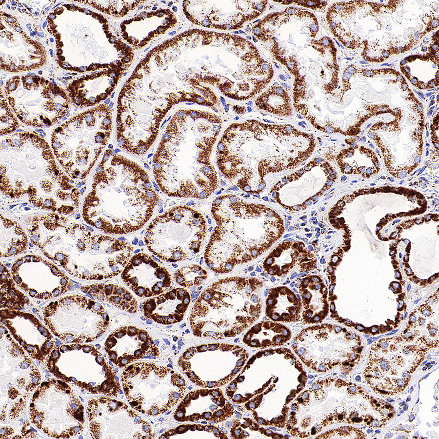 TFAM Recombinant Rabbit mAb