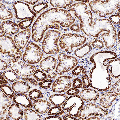 TFAM Recombinant Rabbit mAb