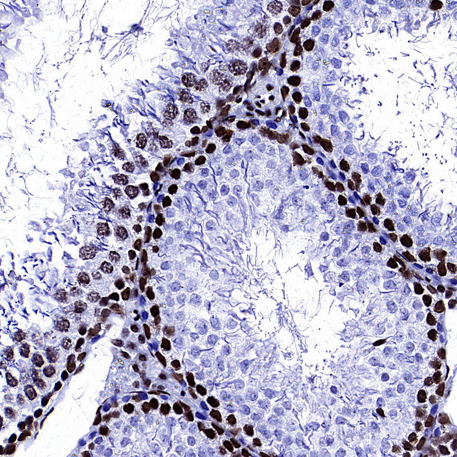 TOP2B Recombinant Rabbit mAb (S-4452-44)