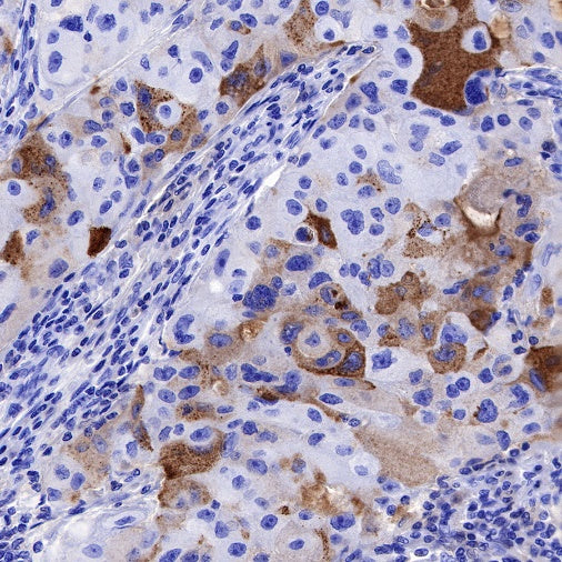 NGAL Recombinant Rabbit mAb (S-473-22)