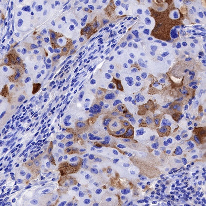 NGAL Recombinant Rabbit mAb (S-473-22)