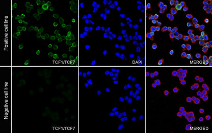 TCF1/TCF7 Recombinant Rabbit mAb (S-3486)