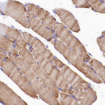 VDAC3 Rabbit Polyclonal Antibody