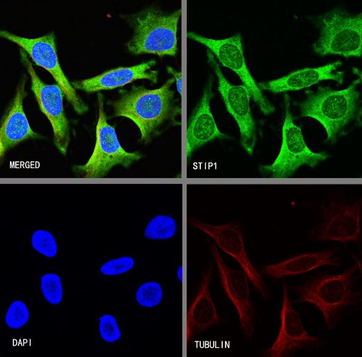 STIP1 Recombinant Rabbit mAb (S-680-39)
