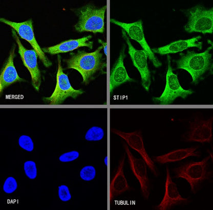 STIP1 Recombinant Rabbit mAb (S-680-39)