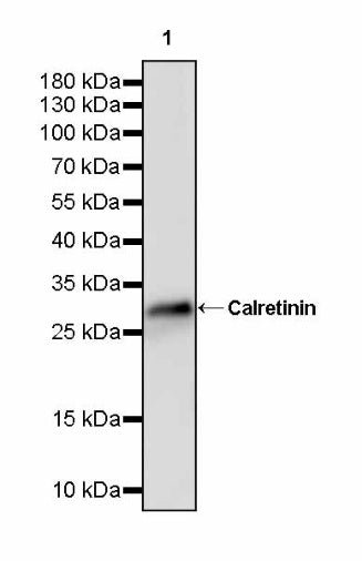 Calretinin Recombinant Rabbit mAb (SDT-2773-21)