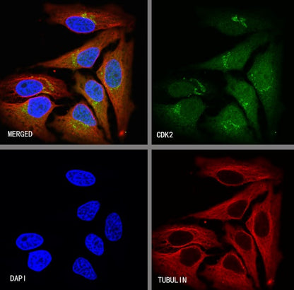 CDK2 Recombinant Rabbit mAb (S-1308-13)
