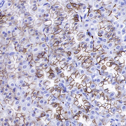 ALCAM Recombinant Rabbit mAb (S-4080-40)