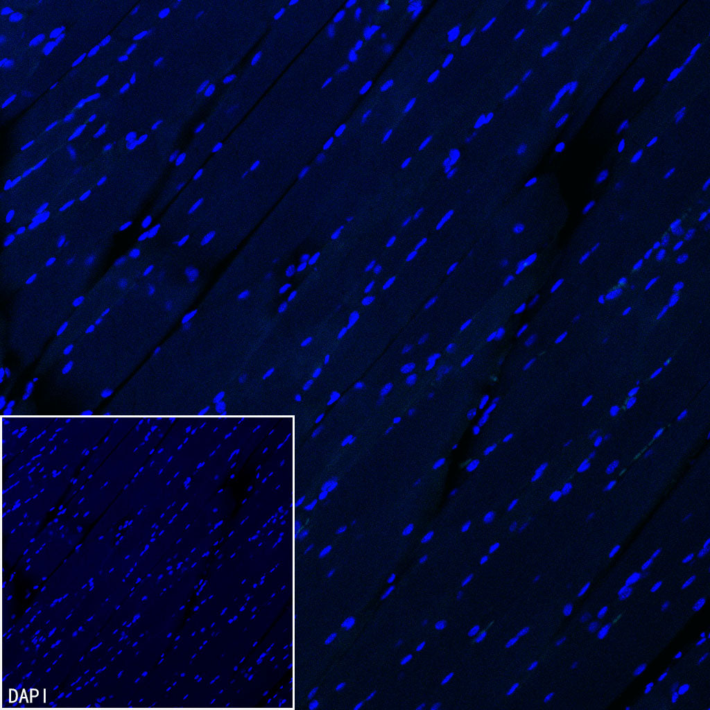 Pklr Recombinant Rabbit mAb (S-4114-40)