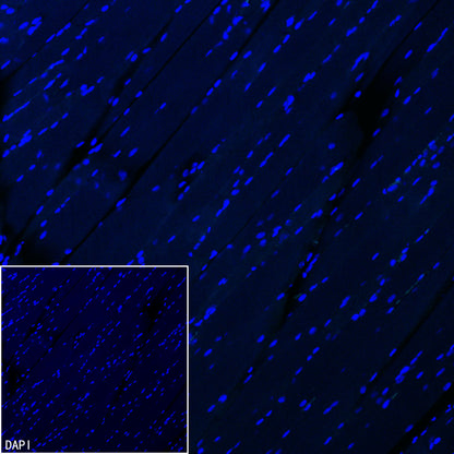 Pklr Recombinant Rabbit mAb (S-4114-40)
