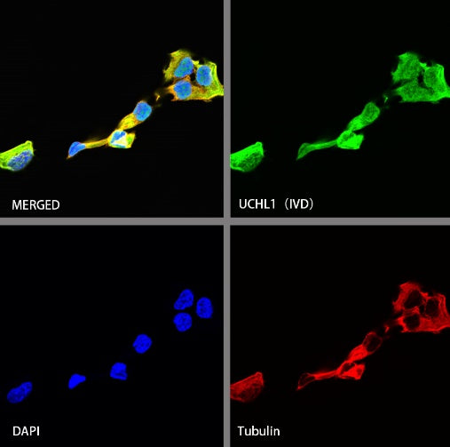 UCHL1 Rabbit Polyclonal Antibody