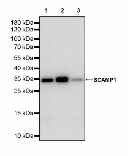 SCAMP1 Rabbit Polyclonal Antibody