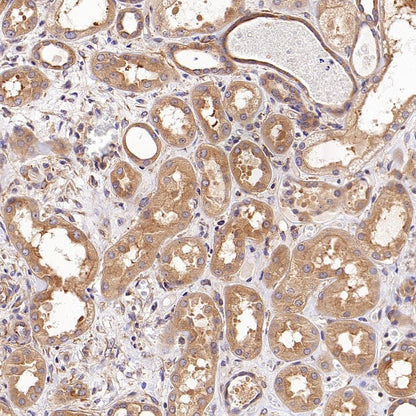 SHARPIN Recombinant Rabbit mAb (S-2356-308)